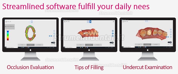 Runyes 3DS Scanner Intraorale Digitale 3D Dentale Scansione Senza Polvere a Colori Reali